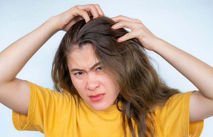 Woman scratching scalp due by sunflower allergy
