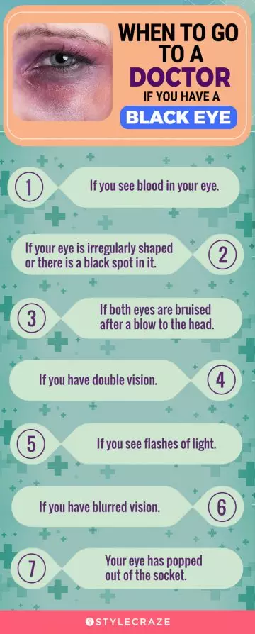 when to go to a doctor if you have a black eye (infographic)