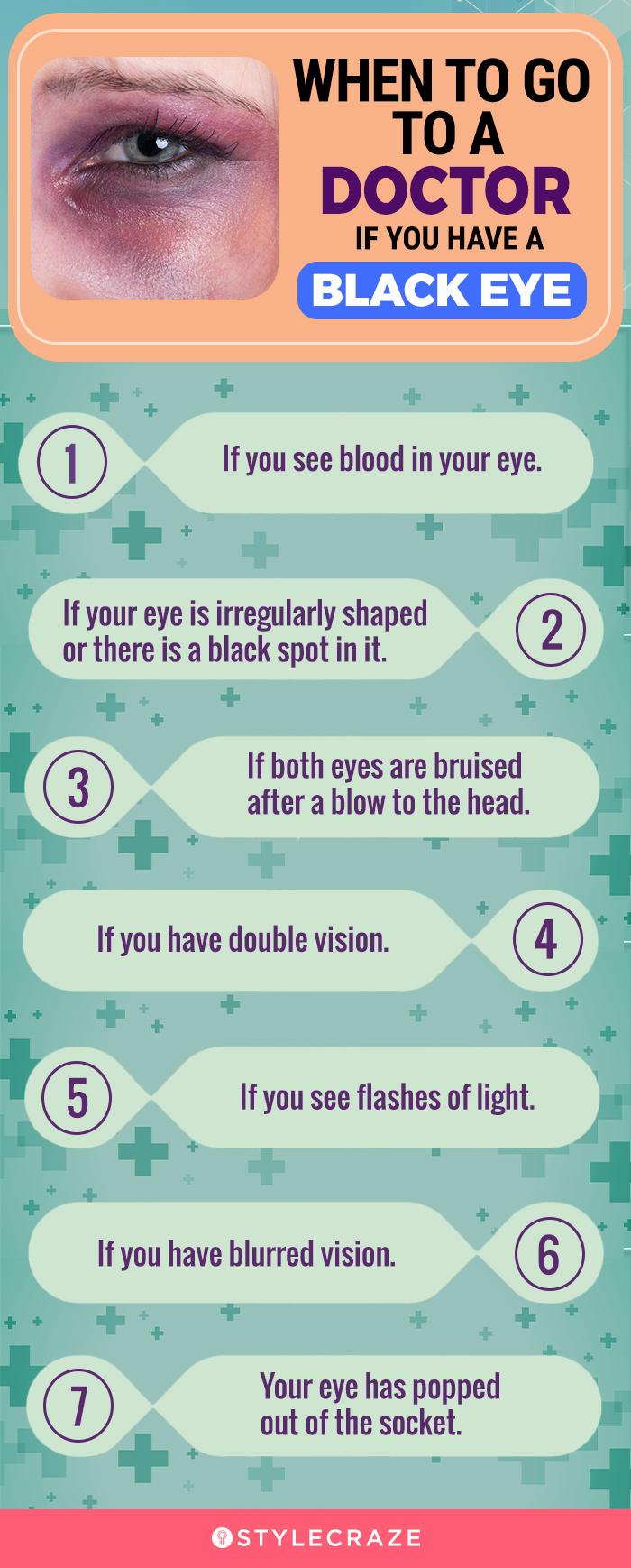 How to get rid of a black eye: Remedies and treatments