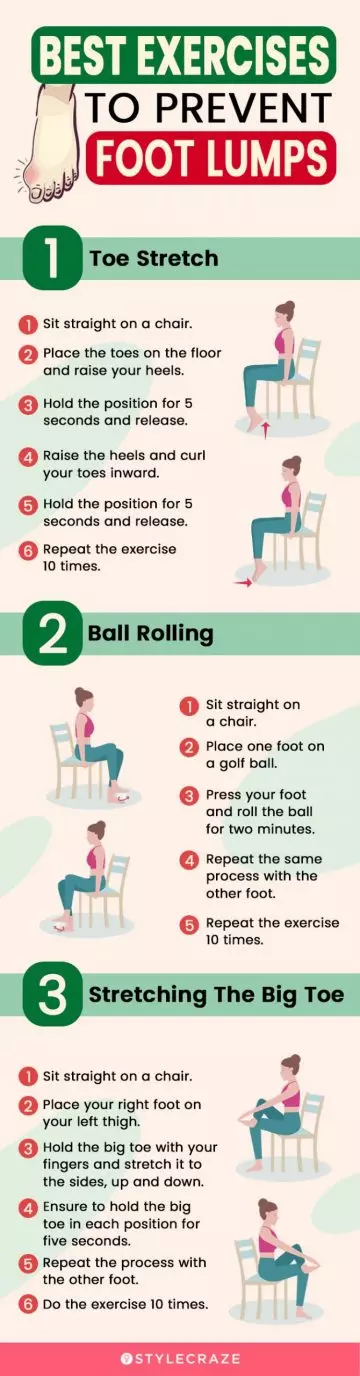 best exercises to prevent foot lumps (infographic)