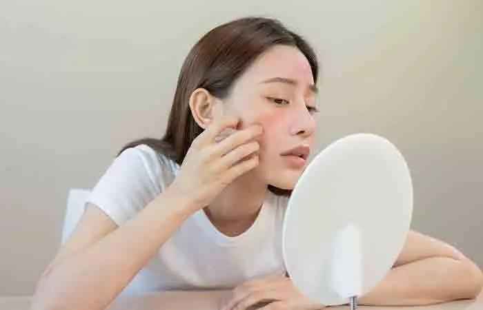 Never-Use-Foundation-To-Mask-Blemishes