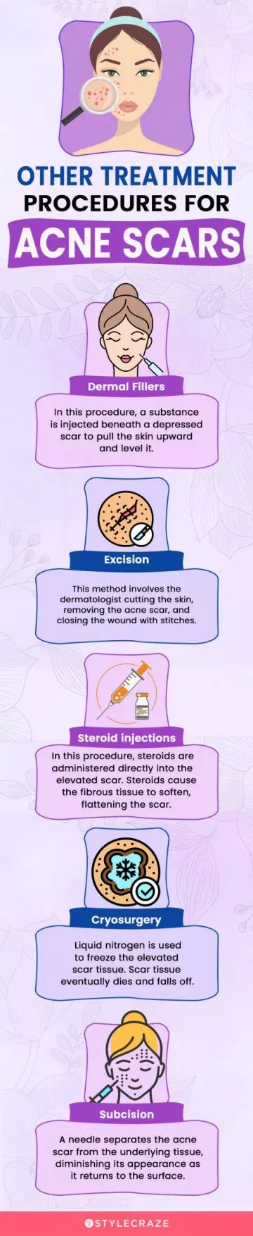 other treatment procedures for acne scars (infographic)
