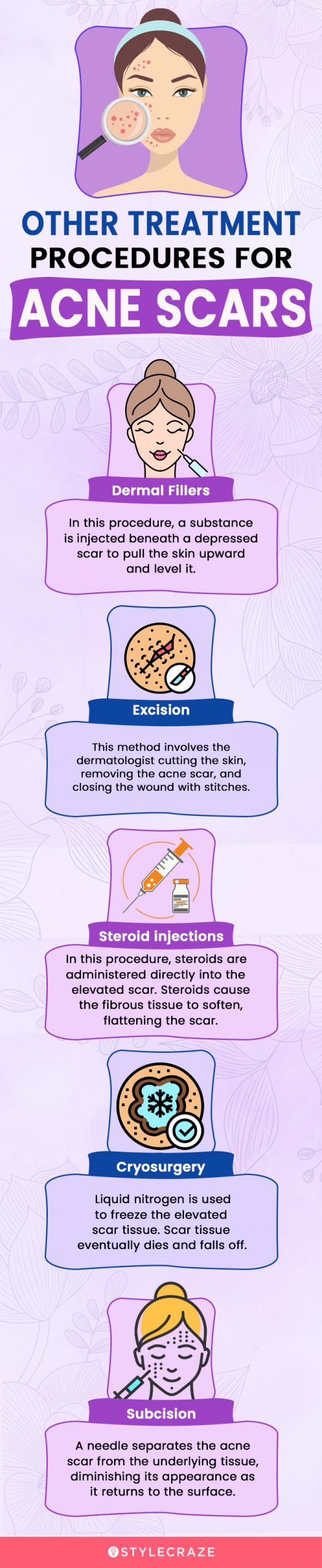 other treatment procedures for acne scars [infographic]
