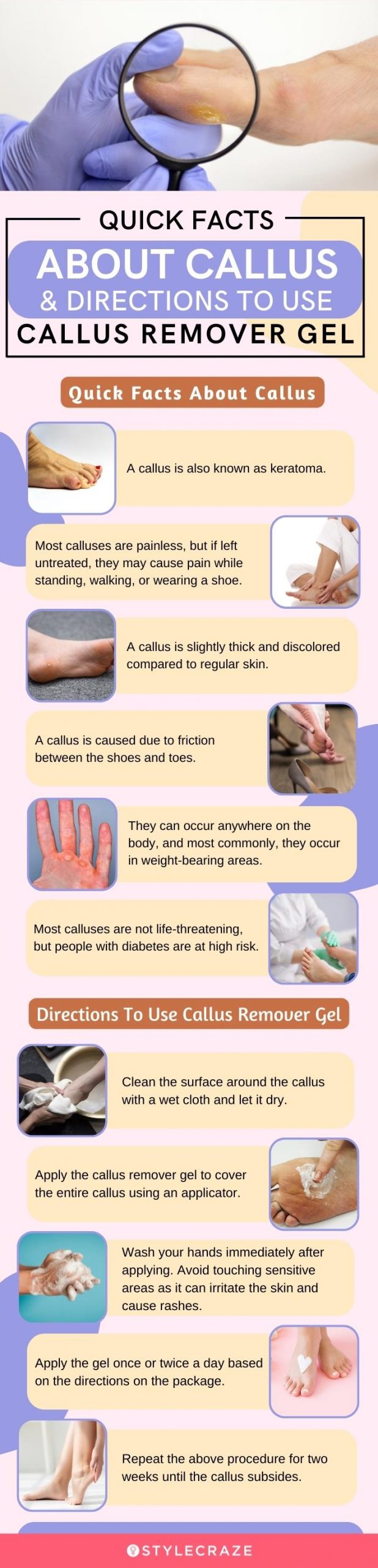 Quick Facts About Callus And Directions To Use Callus Remover Gel [infographic]
