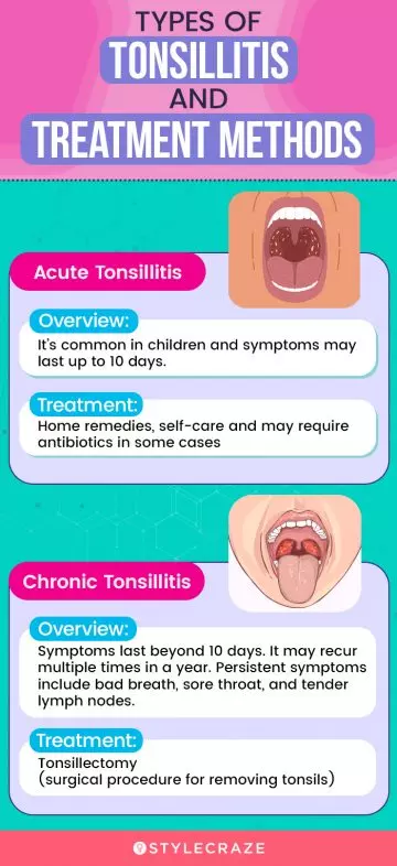 types of tonsillitis and treatment methods (infographic)