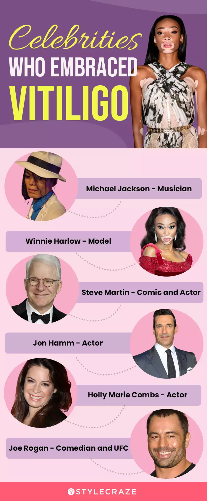 celebrities who embraced vitiligo (infographic)