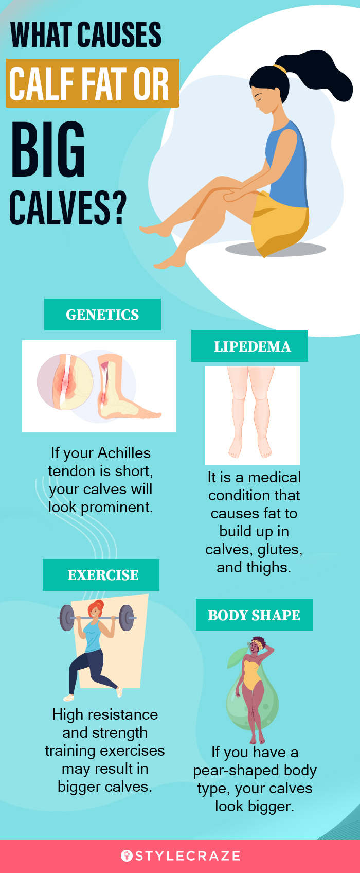 what causes calf fat or big calf (infographic)