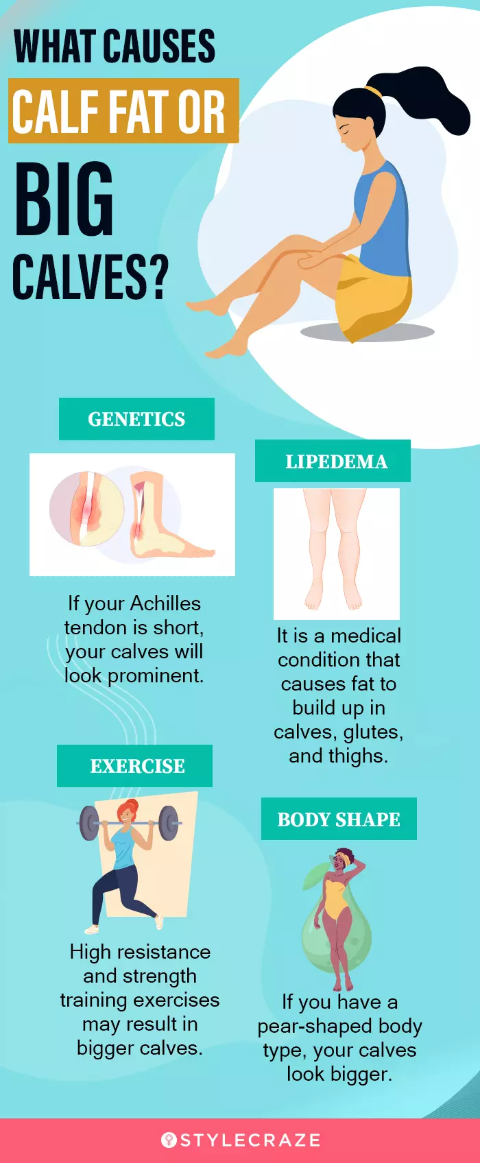 what causes calf fat or big calf (infographic)