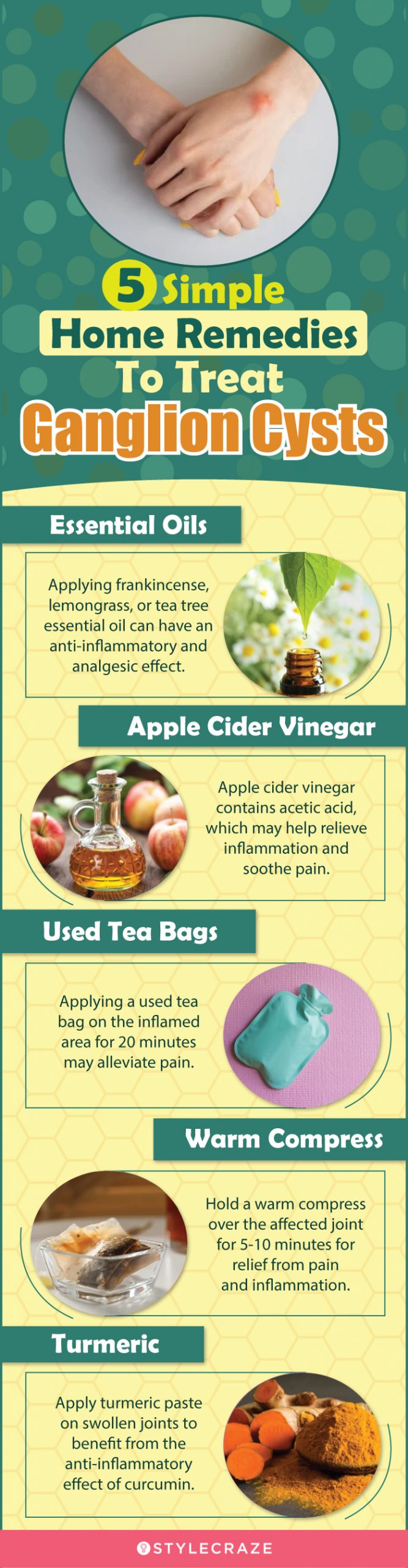 5 simple home remedies to treat ganglion cysts (infographic)