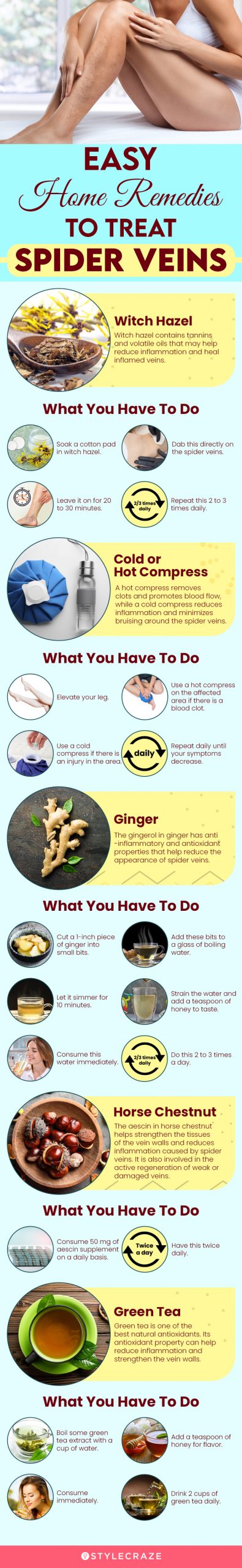 easy home remedies to treat spider veins (infographic)