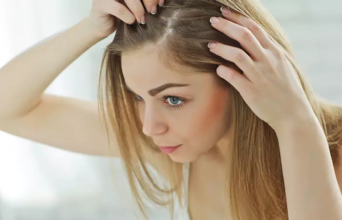 Hair Loss