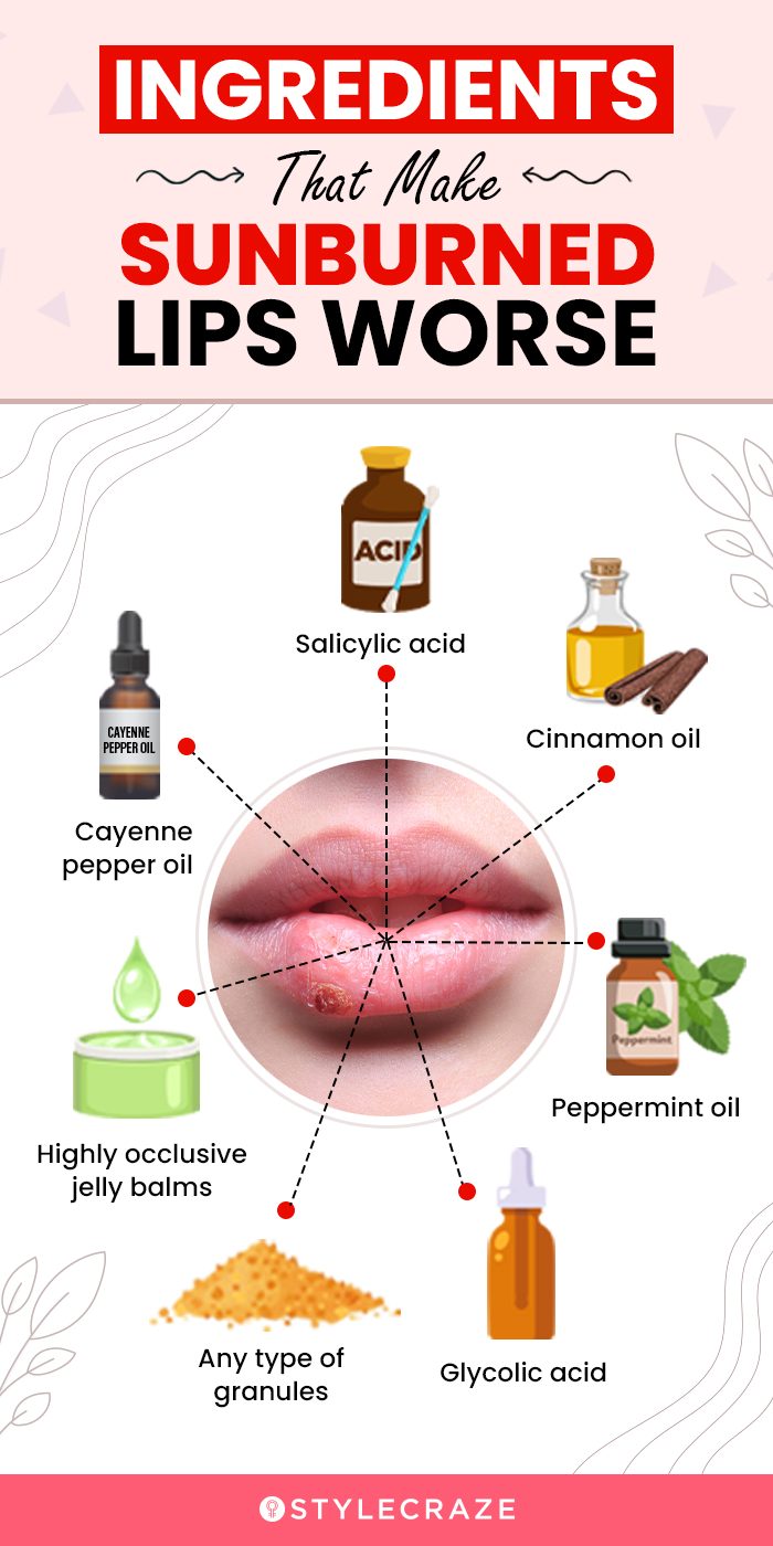ingredients that make sunburned lips worse (infographic)