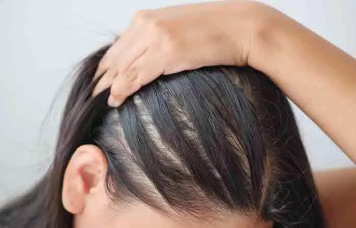 It-Might-Cause-Hair-Thinning