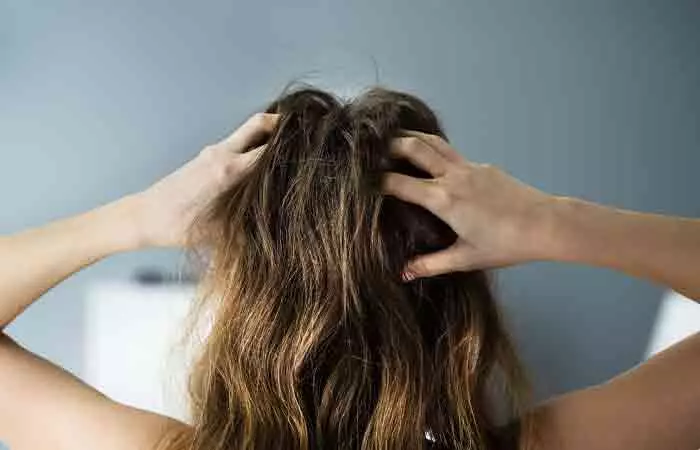 It-Might-Make-Your-Scalp-Itchy