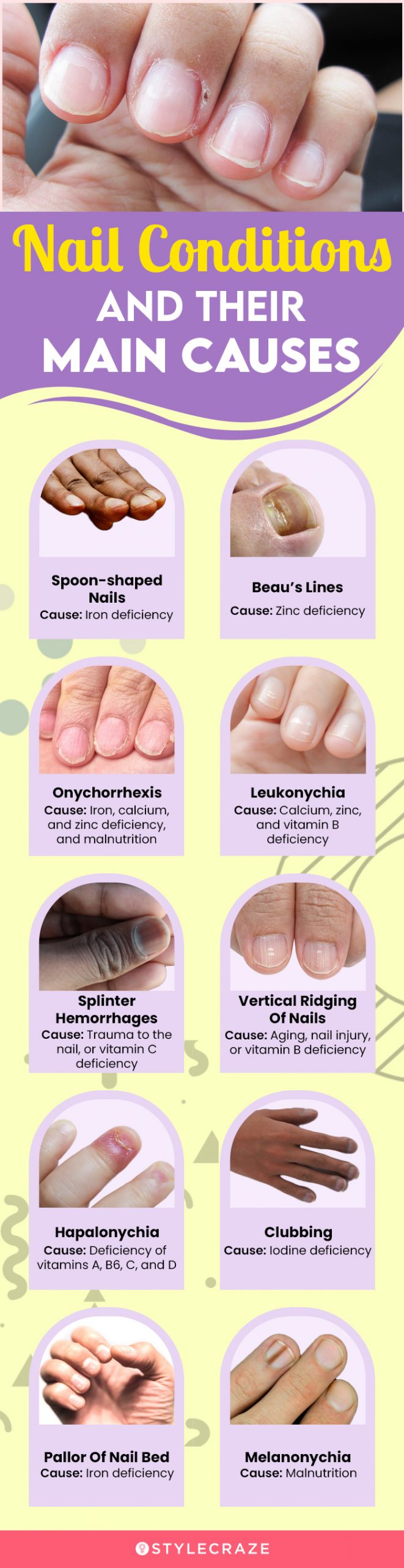 nail conditions and their main causes (infographic)