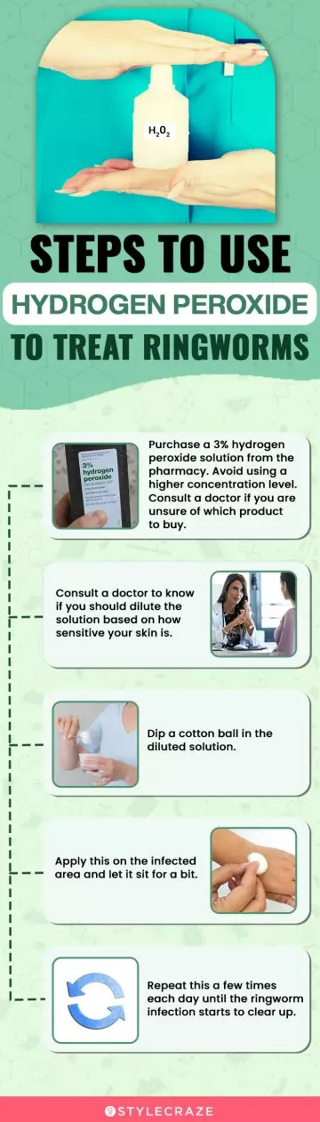 steps to use hydrogen peroxide to treat ringworms (infographic)