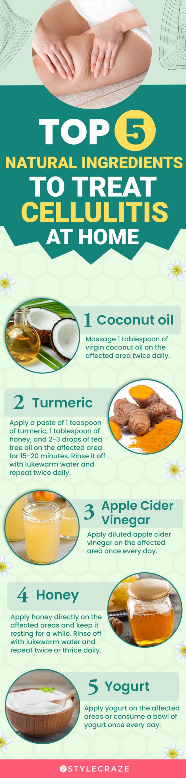 top 5 natural ingredients to treat cellulitis at home (infographic)