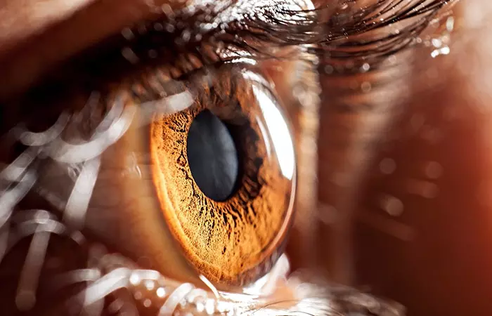 Vision