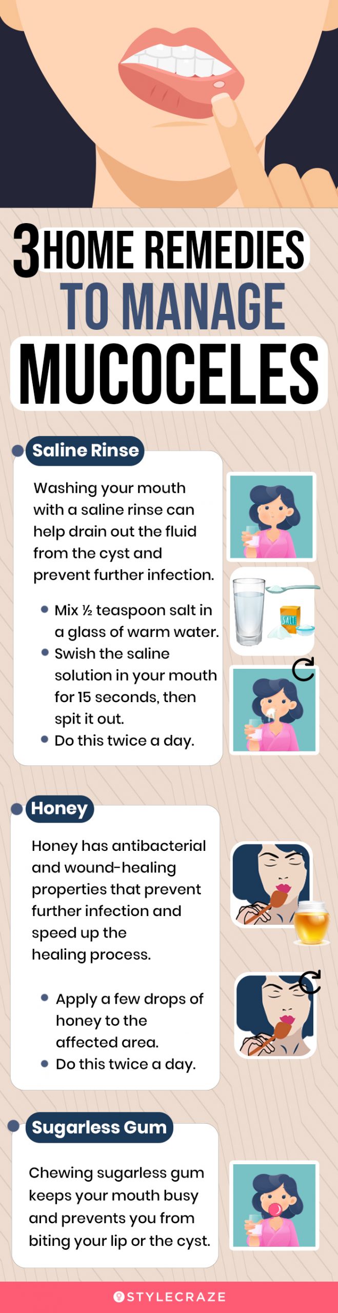 3 home remedies to manage mucoceles (infographic)