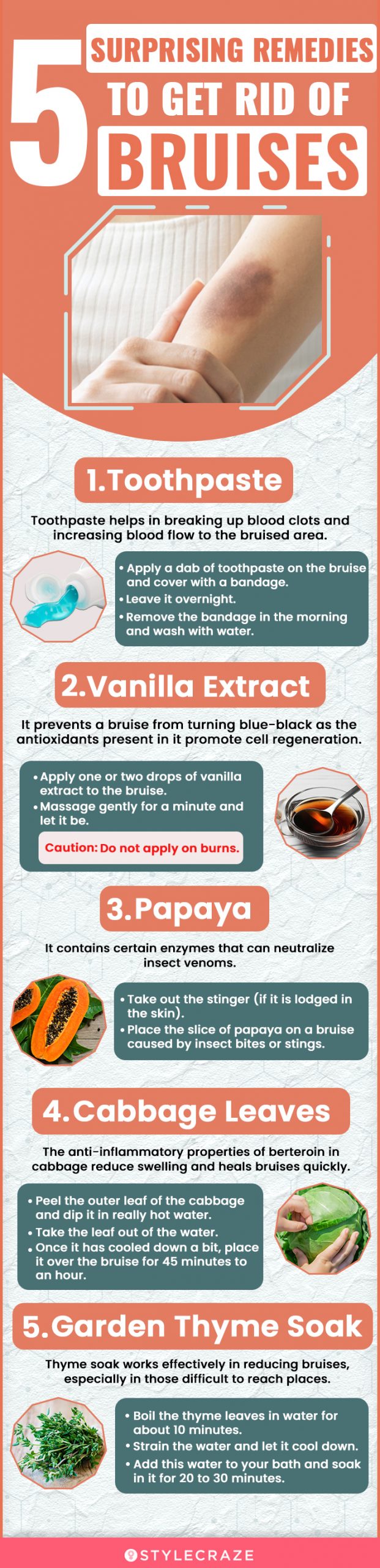 5 surprising remedies to get rid of bruises (infographic)