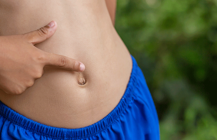 A Protruding Belly Button
