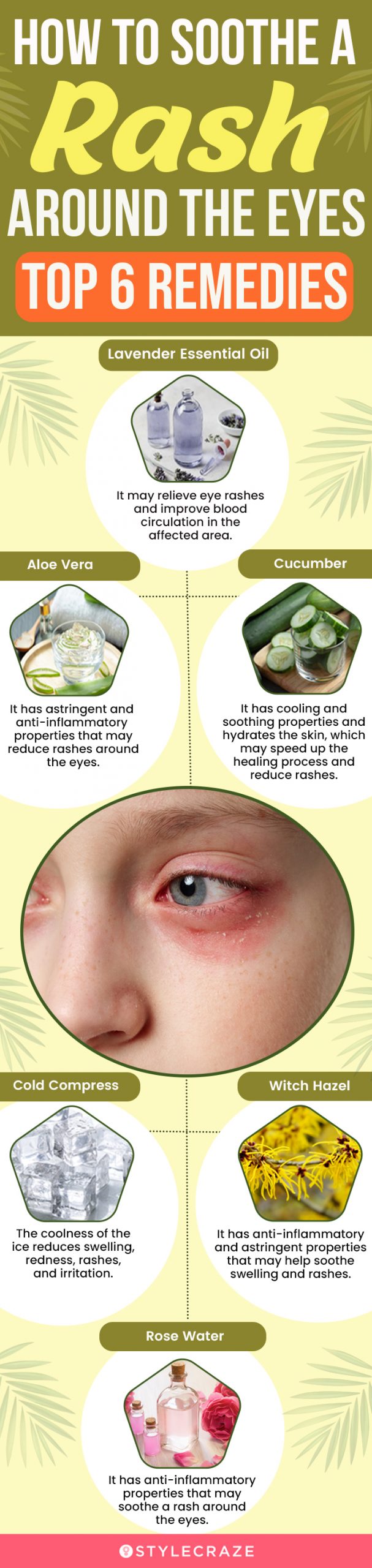 how to soothe a rash around the eyes top 6 remedies (infographic)