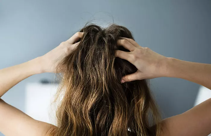 Itchy Scalp