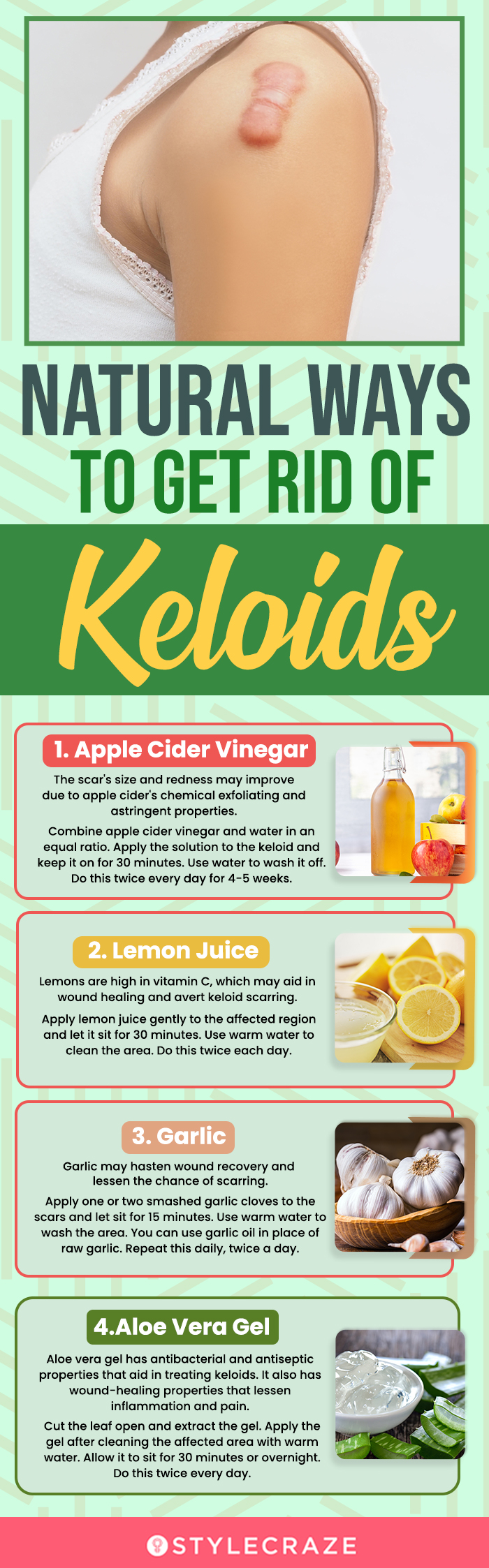 natural ways to get rid of keloids (infographic)