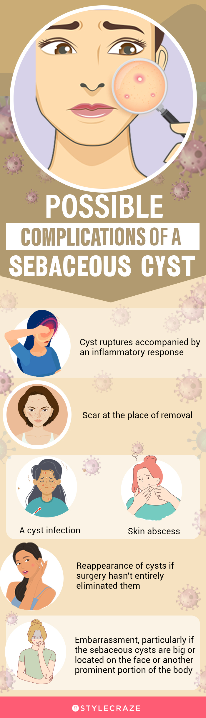 possible complications of a sebaceous cyst (infographic)