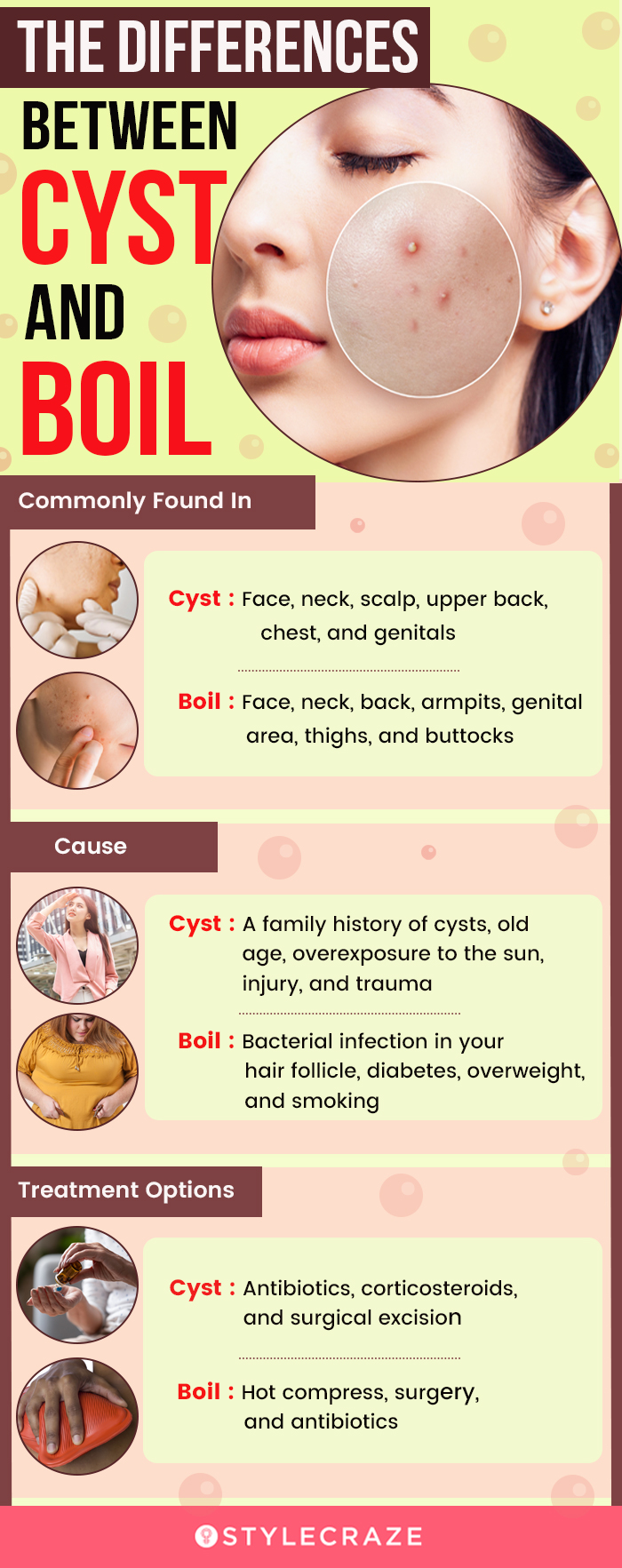 the differences between cyst and boil (infographic)