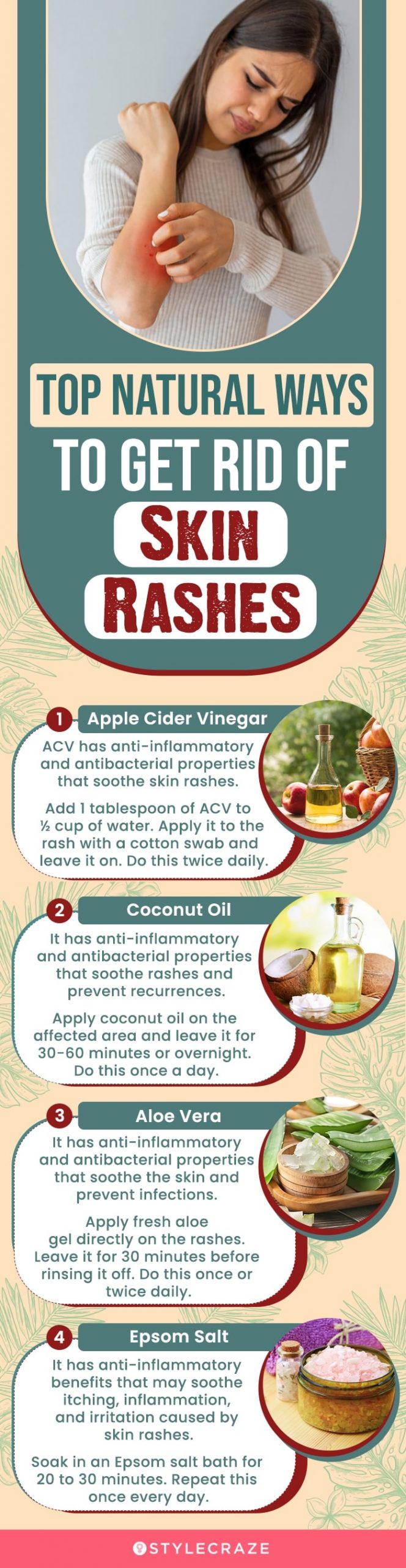 top natural ways to get rid of skin rashes [infographic]