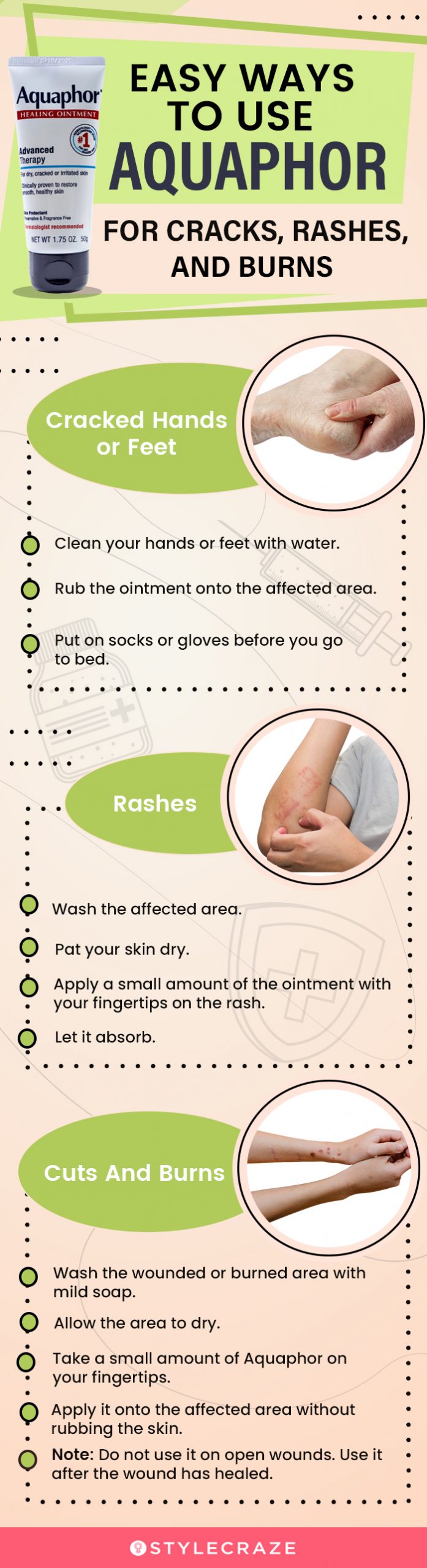 easy ways to use aquaphor for cracks, rashes, and burns [infographic]