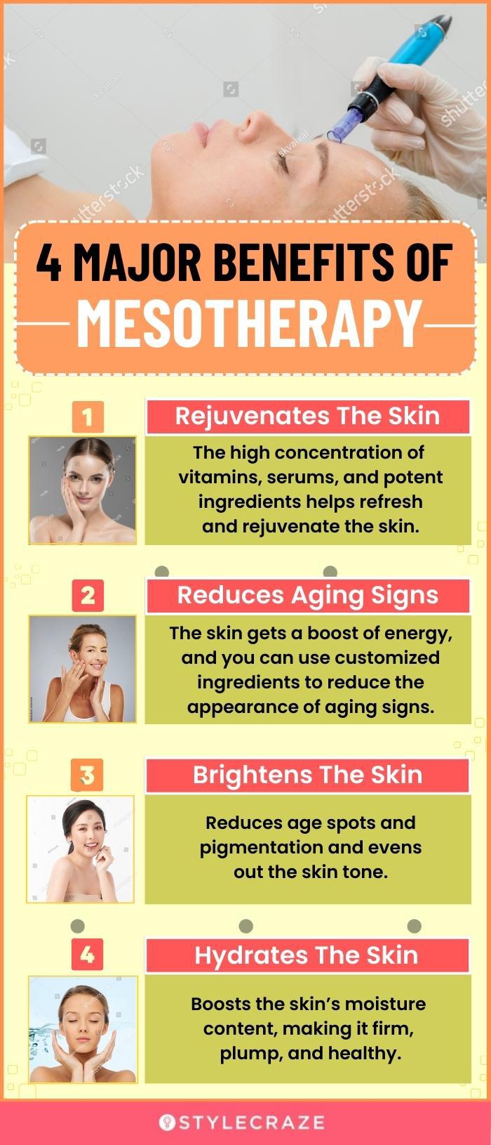 4 major benefits of mesotherapy (infographic)