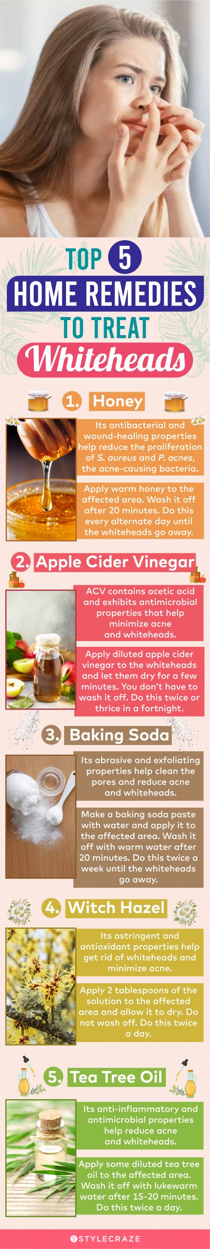 top 5 home remedies to treat whiteheads (infographic)