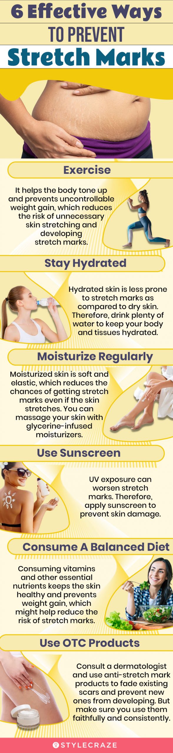 6 effective ways to prevent stretch marks (infographic)