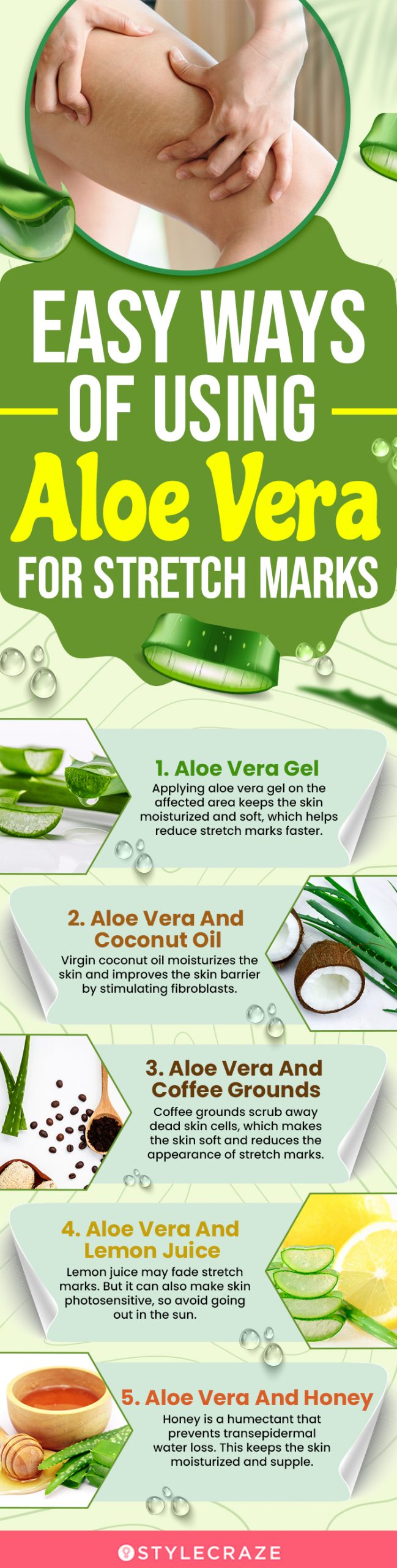 aloe vera for stretch marks (infographic)