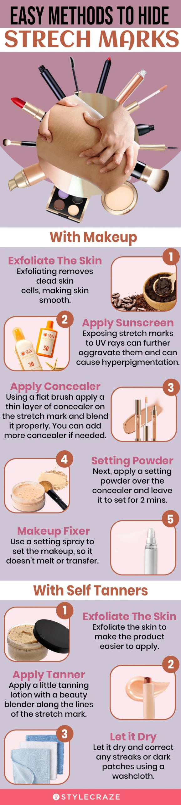 easy methods to hide stretch marks [infographic]
