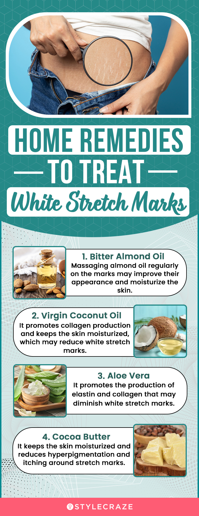 home remedies to treat white stretch marks [infographic]