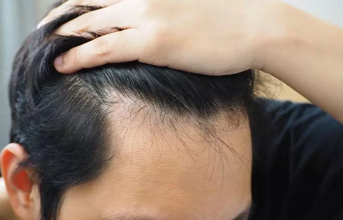How To Differentiate Between New Hair Growth And Hair Breakage