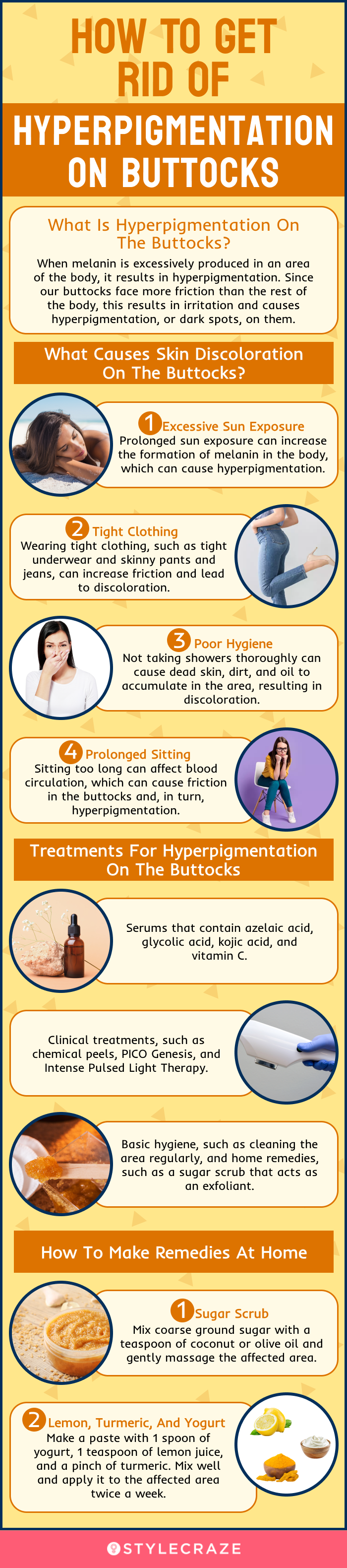 how to get rid of hyperpigmentation on buttocks (infographic)