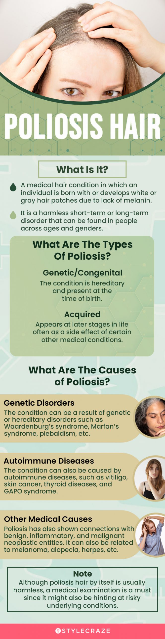 poliosis hair (infographic)