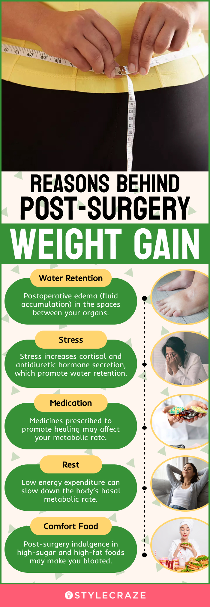 reasons behind post surgery weight gain (infographic)