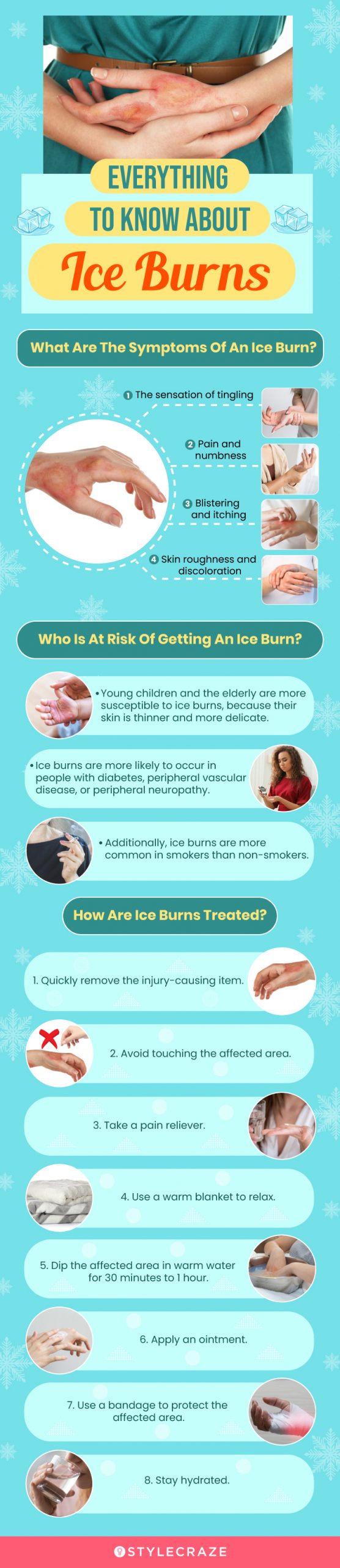 everything to know about ice burns (infographic)