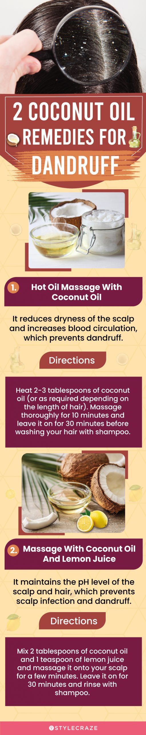 2 coconut oil remedies for dandruff (infographic)