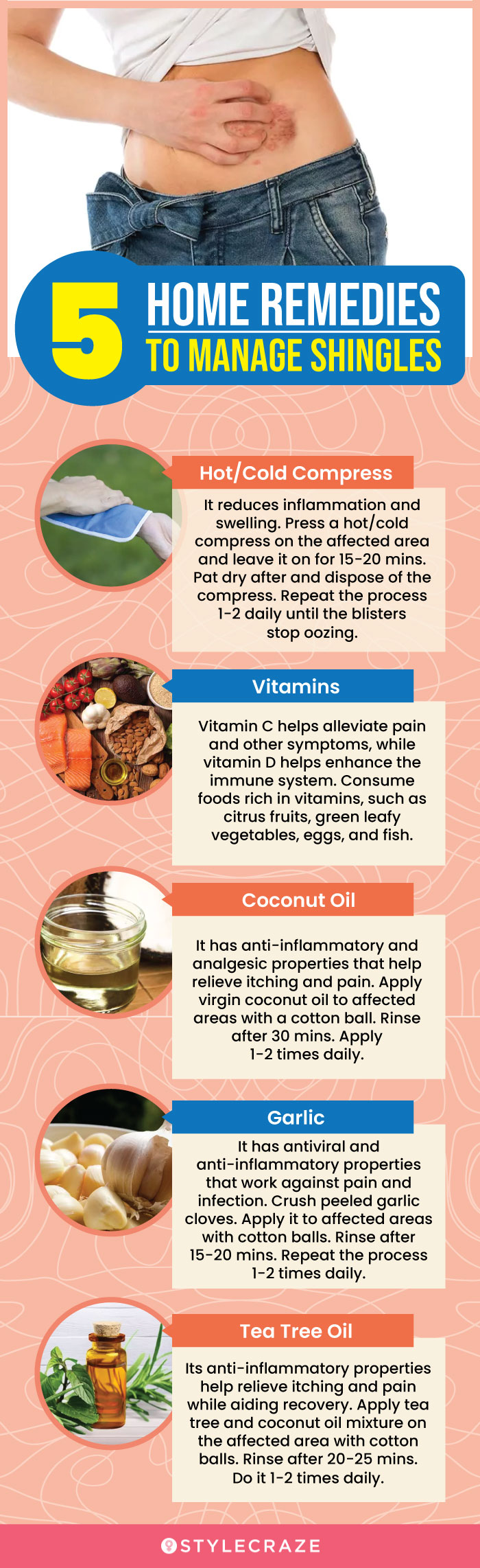 5 home remedies to manage shingles (infographic)