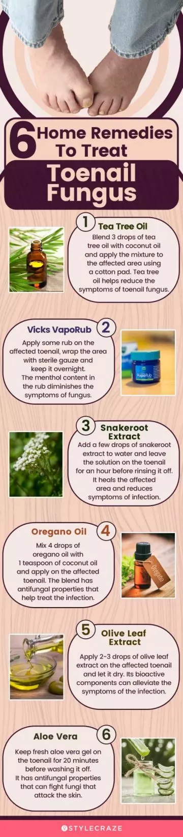 6 home remedies to treat toenail fungus (infographic)