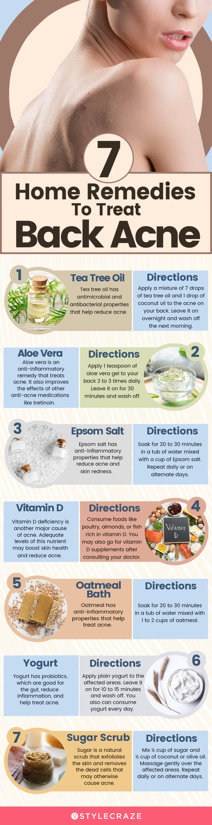 7 home remedies to treat back acne (infographic)