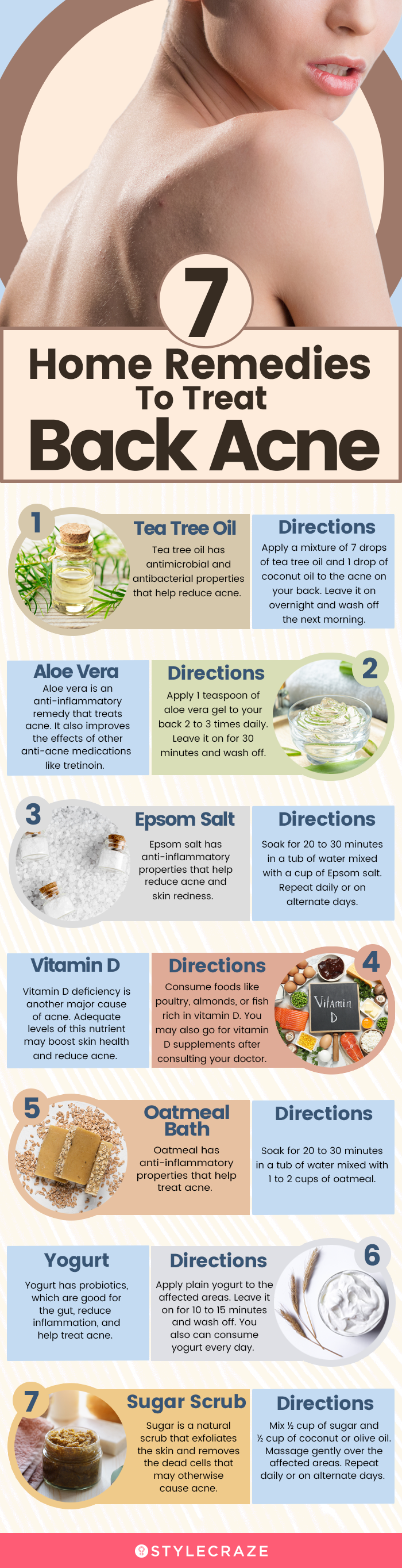 How To Get Rid Of Back Acne Using Home Remedies