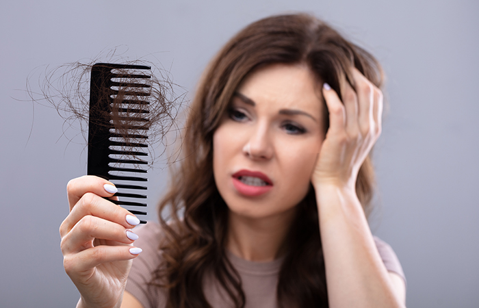 A woman suffering from hair loss