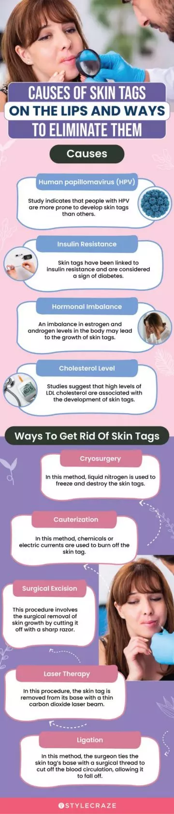 causes of skin tags on the lips and ways to eliminate them (infographic)